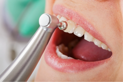 polishing teeth